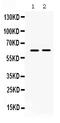 Lysyl oxidase homolog 1 antibody, PB9719, Boster Biological Technology, Western Blot image 