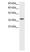 SMAD Family Member 6 antibody, PA1-24467, Invitrogen Antibodies, Western Blot image 