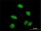 E3 SUMO-protein ligase PIAS2 antibody, H00009063-M01, Novus Biologicals, Immunocytochemistry image 