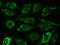 Succinate Dehydrogenase Complex Flavoprotein Subunit A antibody, GTX02249, GeneTex, Immunofluorescence image 