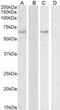 HSP13 antibody, NBP2-26194, Novus Biologicals, Western Blot image 