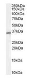 Ring Finger Protein 115 antibody, orb19287, Biorbyt, Western Blot image 