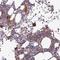 Rho Associated Coiled-Coil Containing Protein Kinase 1 antibody, NBP2-13244, Novus Biologicals, Immunohistochemistry paraffin image 