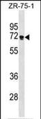Zinc Finger Protein 654 antibody, PA5-35229, Invitrogen Antibodies, Western Blot image 