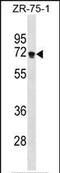 Zinc Finger Protein 654 antibody, PA5-35229, Invitrogen Antibodies, Western Blot image 