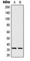 ELOVL Fatty Acid Elongase 1 antibody, MBS8234874, MyBioSource, Western Blot image 