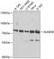 AlkB Homolog 8, TRNA Methyltransferase antibody, GTX65809, GeneTex, Western Blot image 