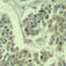 Eukaryotic Translation Initiation Factor 2 Subunit Alpha antibody, LS-C335984, Lifespan Biosciences, Immunohistochemistry paraffin image 