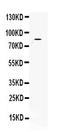 Choline O-Acetyltransferase antibody, A01192-2, Boster Biological Technology, Western Blot image 