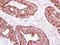 Caseinolytic Mitochondrial Matrix Peptidase Proteolytic Subunit antibody, PA5-30268, Invitrogen Antibodies, Immunohistochemistry frozen image 