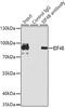 Eukaryotic Translation Initiation Factor 4B antibody, GTX33175, GeneTex, Immunoprecipitation image 