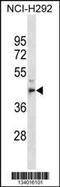 Metallophosphoesterase 1 antibody, 59-985, ProSci, Western Blot image 