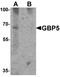 Guanylate-binding protein 5 antibody, A07110, Boster Biological Technology, Western Blot image 