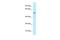 Family With Sequence Similarity 114 Member A2 antibody, A16246, Boster Biological Technology, Western Blot image 