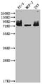 Menin 1 antibody, CSB-RA242999A0HU, Cusabio, Western Blot image 