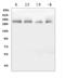 Cytoskeleton Associated Protein 5 antibody, A05324, Boster Biological Technology, Western Blot image 