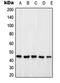 Proteasome 26S Subunit, Non-ATPase 6 antibody, orb214936, Biorbyt, Western Blot image 