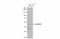 Suppressor Of Variegation 3-9 Homolog 1 antibody, GTX112263, GeneTex, Western Blot image 