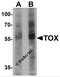 Thymocyte selection-associated high mobility group box protein TOX antibody, 6987, ProSci, Western Blot image 