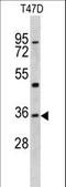 Kruppel Like Factor 6 antibody, LS-C165559, Lifespan Biosciences, Western Blot image 