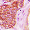 Serine/threonine-protein kinase D1 antibody, LS-C358251, Lifespan Biosciences, Immunohistochemistry paraffin image 