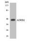 Adrenoceptor Beta 2 antibody, EKC1925, Boster Biological Technology, Western Blot image 