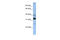 Thioredoxin Related Transmembrane Protein 4 antibody, 26-432, ProSci, Enzyme Linked Immunosorbent Assay image 