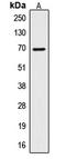 CTP Synthase 1 antibody, LS-C352065, Lifespan Biosciences, Western Blot image 