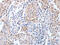 Apurinic/Apyrimidinic Endodeoxyribonuclease 1 antibody, CSB-PA242845, Cusabio, Immunohistochemistry paraffin image 