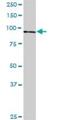 NOP14 Nucleolar Protein antibody, H00008602-B01P, Novus Biologicals, Western Blot image 