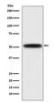 Diacylglycerol O-Acyltransferase 1 antibody, M02522, Boster Biological Technology, Western Blot image 