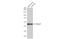 Homer Scaffold Protein 1 antibody, GTX103278, GeneTex, Western Blot image 