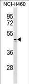 Carbohydrate Sulfotransferase 6 antibody, PA5-48359, Invitrogen Antibodies, Western Blot image 