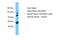 Ral GTPase Activating Protein Catalytic Alpha Subunit 1 antibody, PA5-46609, Invitrogen Antibodies, Western Blot image 