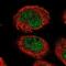 Nuclear Envelope Integral Membrane Protein 1 antibody, NBP1-93649, Novus Biologicals, Immunofluorescence image 