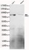 G Protein-Coupled Receptor Kinase 2 antibody, MBS475142, MyBioSource, Western Blot image 