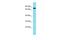 MINDY Lysine 48 Deubiquitinase 4 antibody, A16228, Boster Biological Technology, Western Blot image 