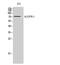 C2 Calcium Dependent Domain Containing 6 antibody, A32253, Boster Biological Technology, Western Blot image 