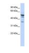 N-Myristoyltransferase 1 antibody, NBP1-54379, Novus Biologicals, Western Blot image 