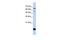 Thioredoxin 2 antibody, GTX45360, GeneTex, Western Blot image 