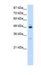 Poly(A) Binding Protein Interacting Protein 1 antibody, NBP1-57310, Novus Biologicals, Western Blot image 