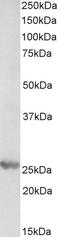 Proteasome Subunit Beta 4 antibody, EB10296, Everest Biotech, Western Blot image 