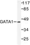 GATA Binding Protein 1 antibody, LS-C176036, Lifespan Biosciences, Western Blot image 
