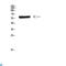 Cytochrome P450 Family 26 Subfamily B Member 1 antibody, LS-C813760, Lifespan Biosciences, Western Blot image 