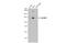 ADAM Metallopeptidase Domain 17 antibody, GTX101358, GeneTex, Western Blot image 