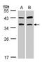 Acid Phosphatase 5, Tartrate Resistant antibody, TA308289, Origene, Western Blot image 
