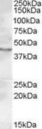 Ceramide Synthase 3 antibody, TA305880, Origene, Western Blot image 