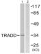 TNFRSF1A Associated Via Death Domain antibody, abx013237, Abbexa, Western Blot image 