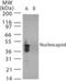 SARS CoV Nucleoprotein antibody, NB100-56049, Novus Biologicals, Western Blot image 