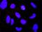 Catenin Alpha 1 antibody, H00001495-M03, Novus Biologicals, Proximity Ligation Assay image 
